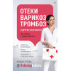 Отеки, варикоз, тромбоз и другие болезни вен. Как лечить и предотвратить