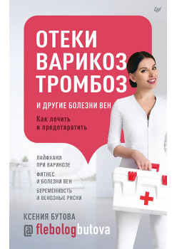 Отеки, варикоз, тромбоз и другие болезни вен. Как лечить и предотвратить