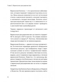 Отеки, варикоз, тромбоз и другие болезни вен. Как лечить и предотвратить