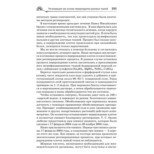 Здоровье человека в нездоровом мире. 2-е изд.