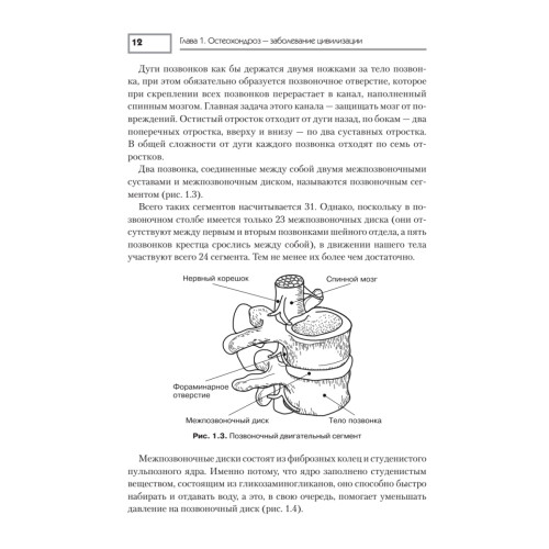 Остеохондроз. Лечение и профилактика
