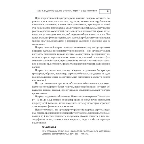 Псориаз. Диета, лечение, профилактика